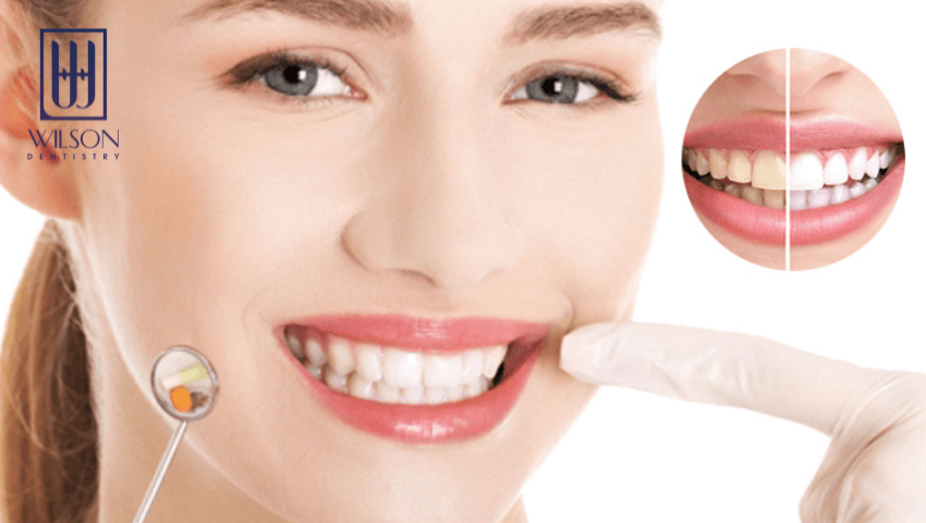 cach-lay-cao-rang-tai-nha-khoa-wilson-co-gi-dac-biet-2