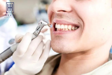 Đánh bóng răng là gì? Những lưu ý khi thực hiện