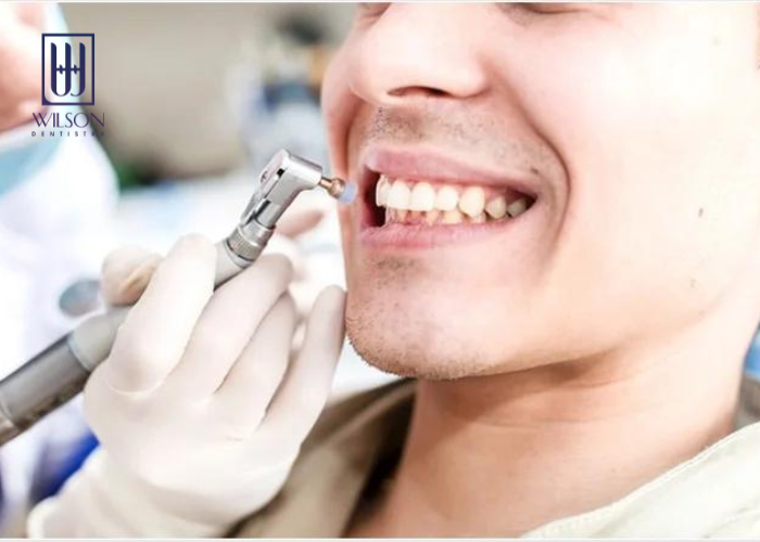 Đánh bóng răng là gì? Những lưu ý khi thực hiện