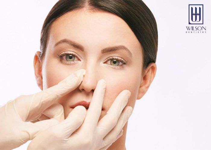 Điểm danh các kỹ thuật nâng xoang phổ biến nhất hiện nay