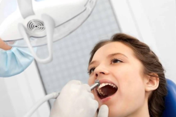 Giải đáp thắc mắc: Lấy cao răng có làm trắng răng không?