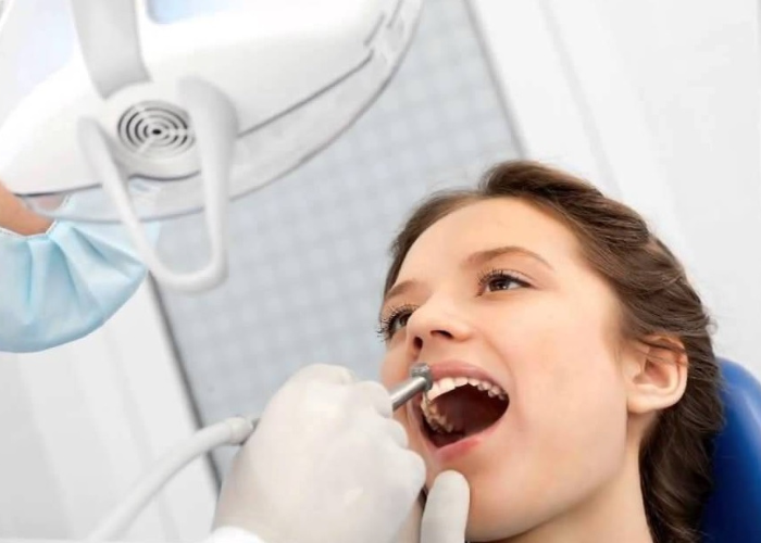 Giải đáp thắc mắc: Lấy cao răng có làm trắng răng không?