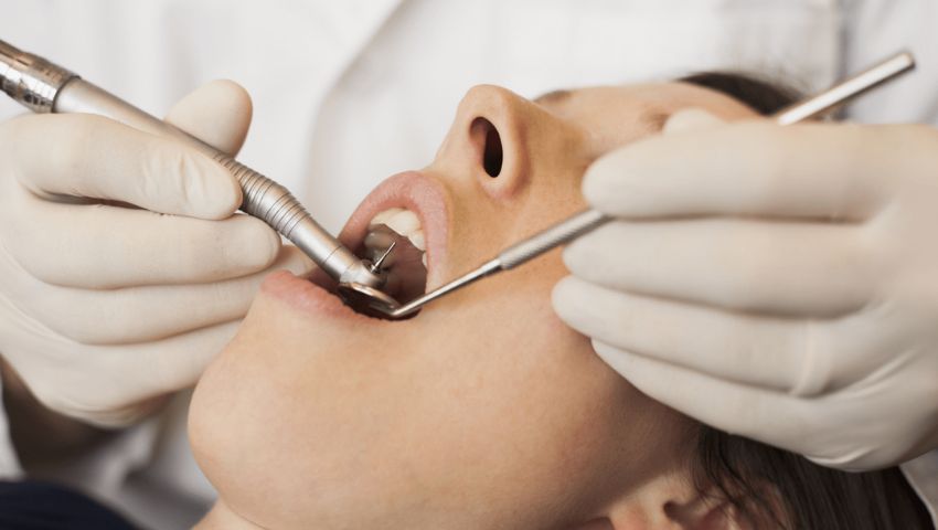 giai-dap-thac-mac-sau-khi-lay-cao-rang-bao-lau-thi-duoc-an-2