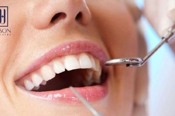 Hệ thống nha khoa Wilson – Địa chỉ lấy cao răng Hà Nội uy tín