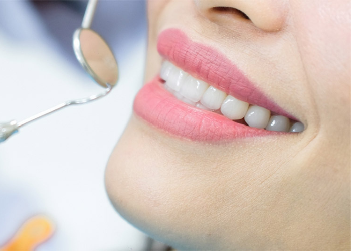 Lấy cao răng 30k có thật không? Có nên sử dụng dịch vụ này không?