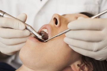 Lấy cao răng mất bao lâu? Có đau hay không?