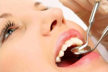 Làm cao răng xong kiêng gì để răng chắc khỏe?