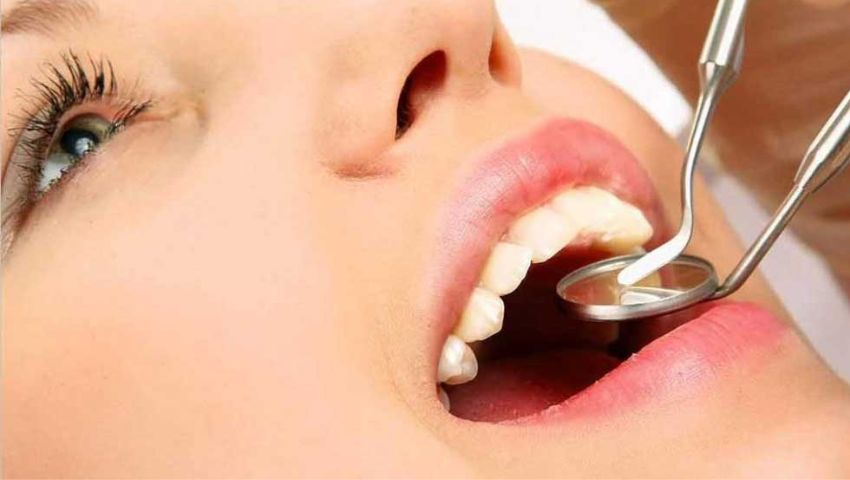 lay-cao-rang-xong-kieng-gi-de-rang-chac-khoe-3