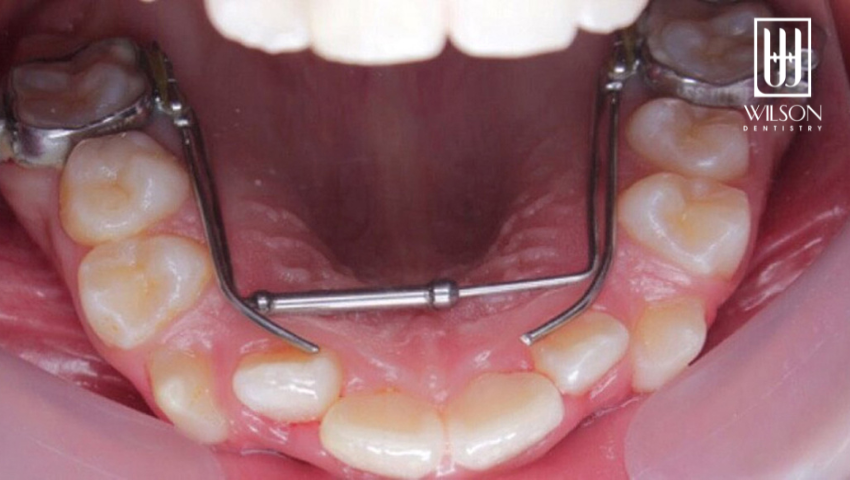 nong-ham-la-gi-nhung-truong-hop-can-nong-ham-1