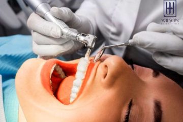 Phẫu thuật cắt lợi đẹp và uy tín tại Nha khoa Wilson