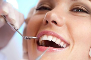 Tìm hiểu quy trình lấy cao răng tại nha khoa Wilson