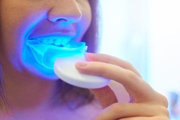 3 loại máy tẩy trắng răng được nhiều người dùng nhất