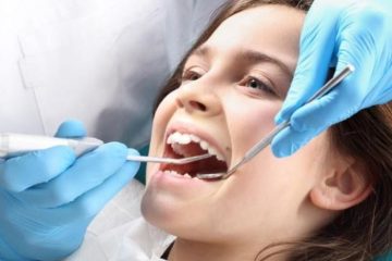 Bao nhiêu tuổi thì lấy cao răng? Địa chỉ lấy cao răng uy tín