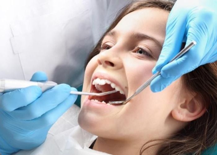 Bao nhiêu tuổi thì lấy cao răng? Địa chỉ lấy cao răng uy tín