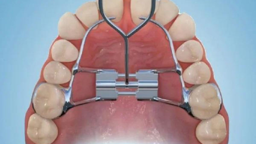 bat-mi-nhung-cach-giam-dau-khi-nong-ham-hieu-qua-1