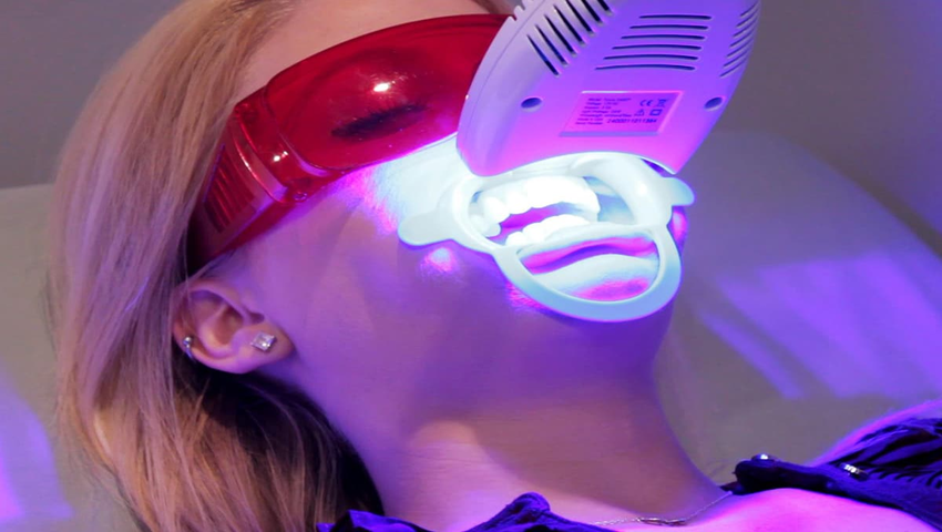 boc-rang-su-co-tay-trang-duoc-khong-1