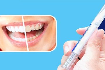 Bút tẩy trắng răng có tốt không? Các loại bút tẩy trắng răng