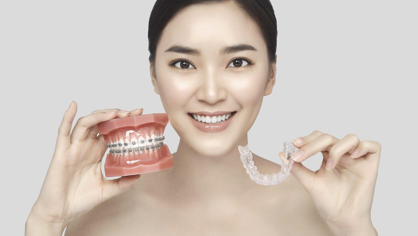 chinh-nha-invisalign-va-nhung-dieu-can-luu-y-2