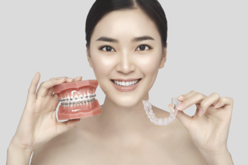 Chỉnh nha Invisalign và những điều cần lưu ý