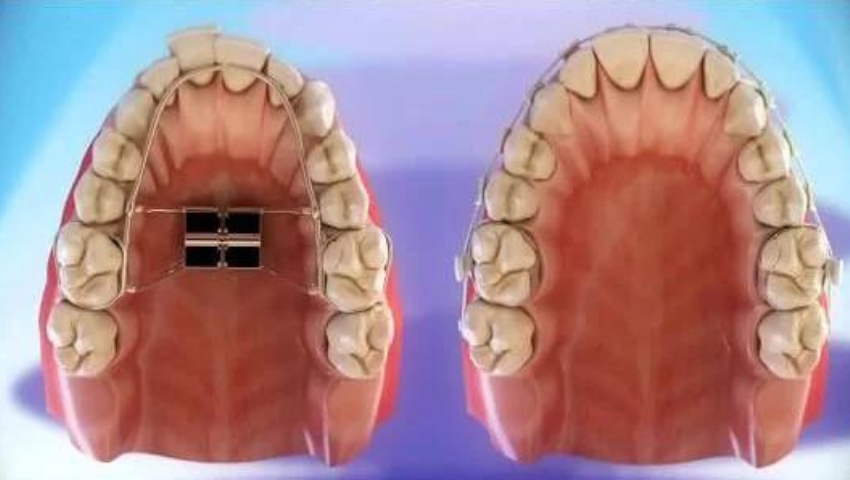 co-the-thuc-hien-vua-nong-ham-vua-nieng-rang-duoc-khong-1