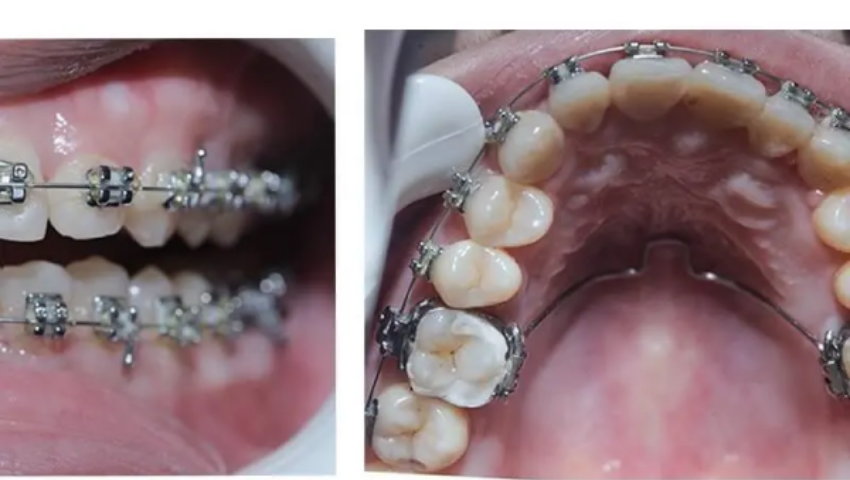 co-the-thuc-hien-vua-nong-ham-vua-nieng-rang-duoc-khong-2