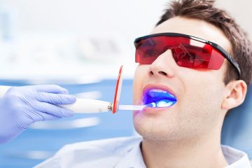 Đèn tẩy trắng răng là gì? Những ai có thể sử dụng đèn tẩy trắng răng