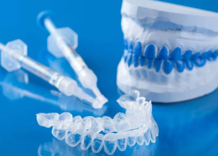 Điều trị viêm lợi bằng máng được thực hiện như thế nào?