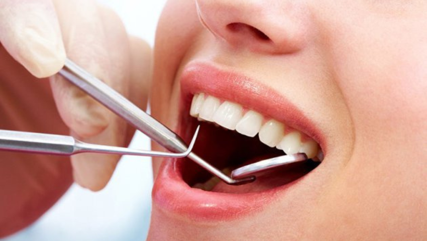 gia-cao-voi-rang-va-danh-bong-rang-loi-ich-khi-thuc-hien-3