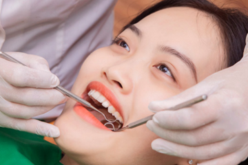 Giá cạo vôi răng và đánh bóng răng? Lợi ích khi thực hiện