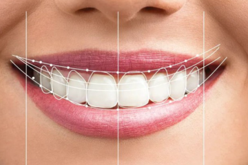 Giải đáp thắc mắc: Cắt lợi có đau không? Những ai nên cắt lợi?