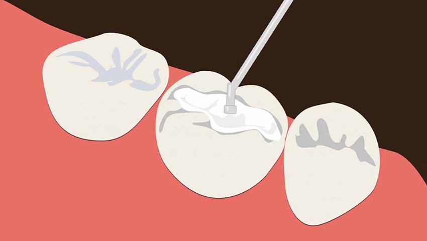 han-rang-tham-my-la-gi-tai-sao-han-rang-tham-my-la-giai-phap-duoc-nhieu-nguoi-lua-chon-1