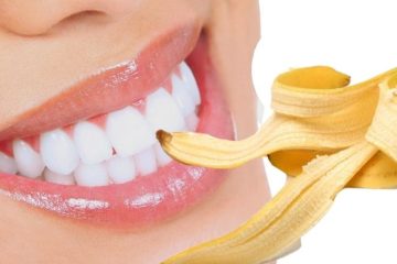 Hướng dẫn cách tự lấy cao răng bằng vỏ chuối tại nhà