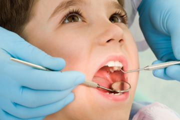 Những cách điều trị viêm tủy răng ở trẻ em hiệu quả