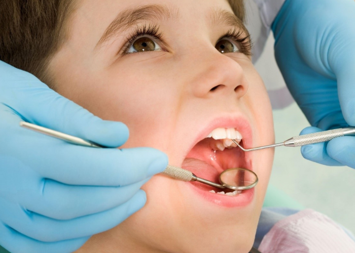 Những cách điều trị viêm tủy răng ở trẻ em hiệu quả