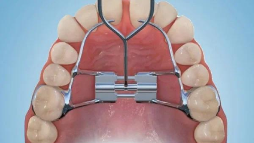 nong-ham-co-dau-khong-nhung-luu-y-khi-thuc-hien-3