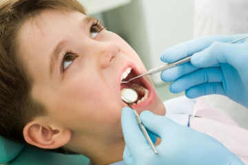 Phương pháp điều trị tủy răng sữa cho trẻ em