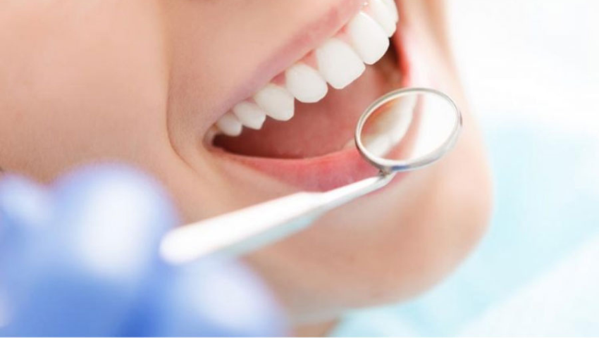 rang-sau-khi-dieu-tri-tuy-can-duoc-cham-soc-va-bao-ve-the-nao-2