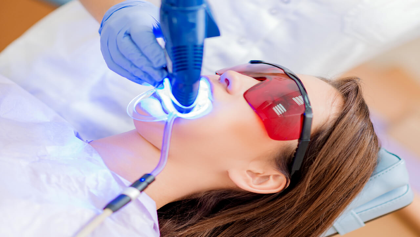 tay-trang-rang-laser-whitening-co-hieu-qua-tuc-thi-khong-2