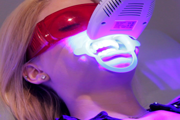 Tẩy trắng răng laser whitening có hiệu quả tức thì không?