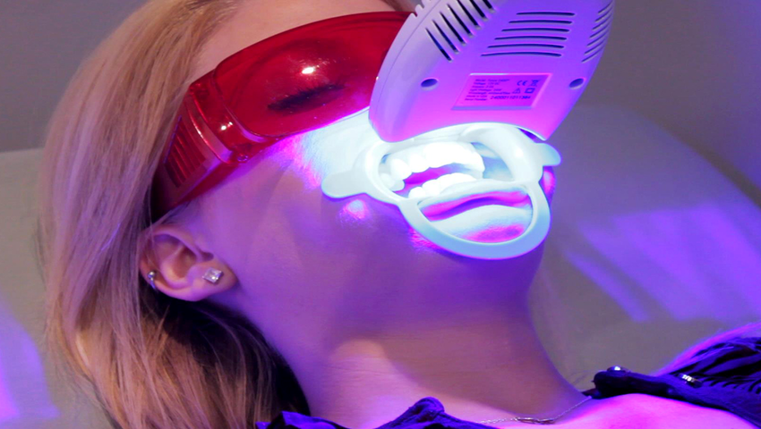 Tẩy trắng răng laser whitening có hiệu quả tức thì không?