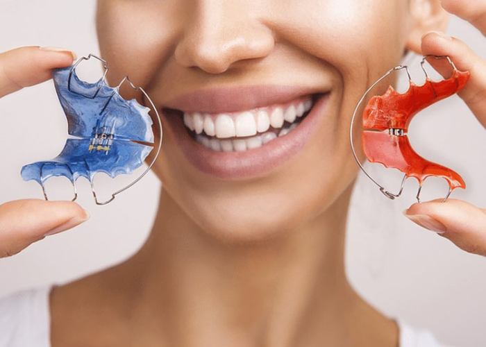 Trước và sau khi nong hàm có thẩy đổi khuôn mặt không?