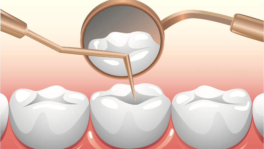 viem-tuy-rang-la-gi-cac-phuong-phap-dieu-tri-viem-tuy-rang-2