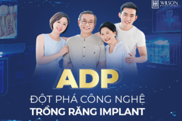 Những ưu điểm chỉ có ở công nghệ chẩn đoán trồng răng Implant ADP tại Nha khoa Wilson