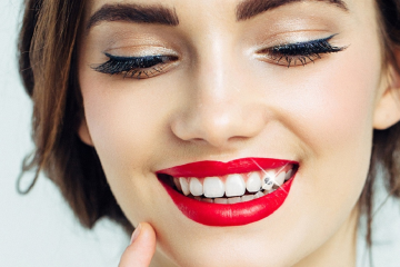 Gắn đá răng khểnh là gì? Quy trình thực hiện