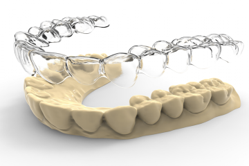 Niềng răng 3D Clear là gì? Ưu nhược điểm của niềng răng 3D Clear