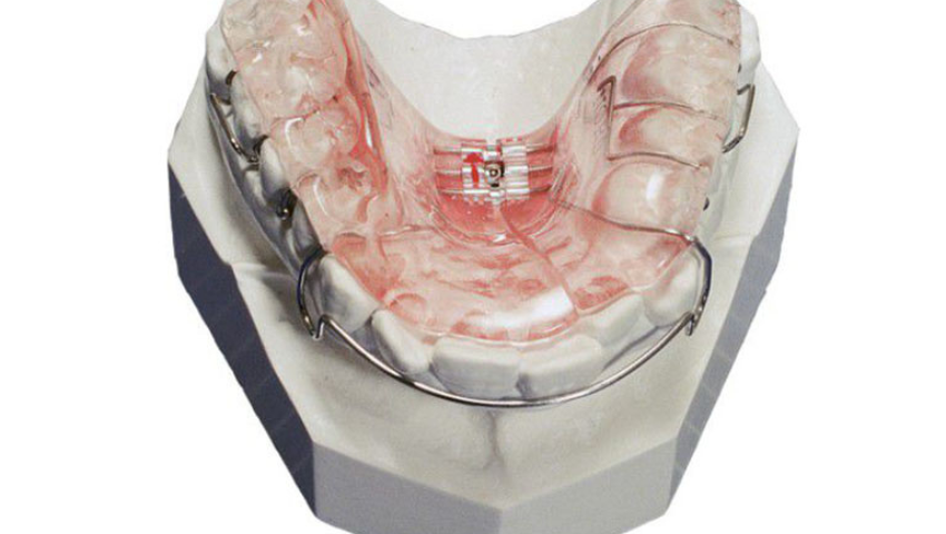 cac-loai-ham-thao-lap-2