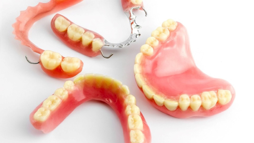 Hàm duy trì tháo lắp – Giải pháp phục hình răng hiệu quả