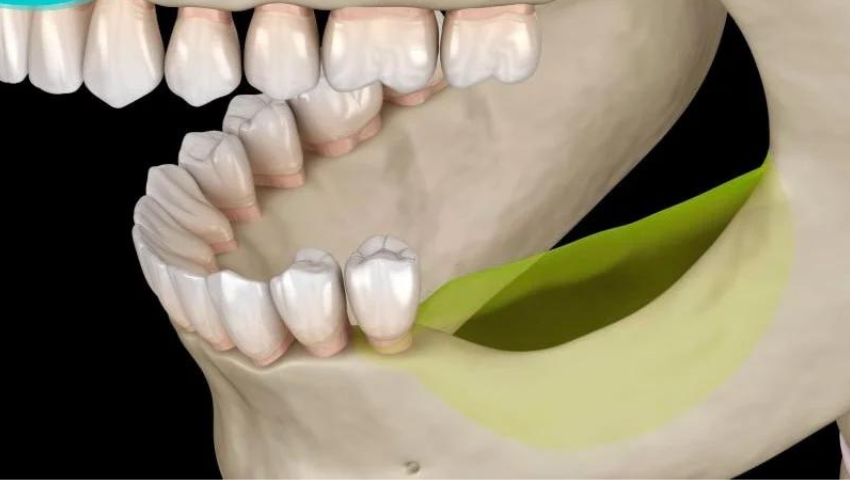 lam-rang-gia-nguyen-ham-thao-lap-3