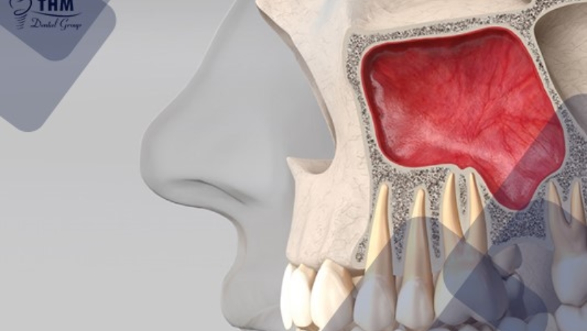 nang-xoang-kin-va-nang-xoang-ho-1