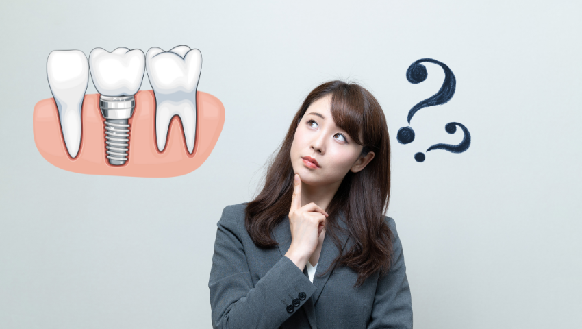 trong-rang-implant-gia-bao-nhieu-1-cai-1